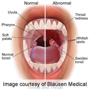 dn25022mic_throat&tonsils_anatomy.jpg