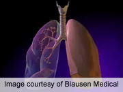 lung_cancer_02.jpg